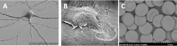 Figure 2:  The differing face of cells. Here we show how cells adapt their morphology (shape) and structure depending on function within the tissue they reside. (A) Nerve cell (http://sciencephotolibrary.tumblr.com/page/38) (B) Osteoclast cell  (http://www.pathologyoutlines.com/topic/bonemarrowosteoclasts), (C) Blood cells, authors own image. 