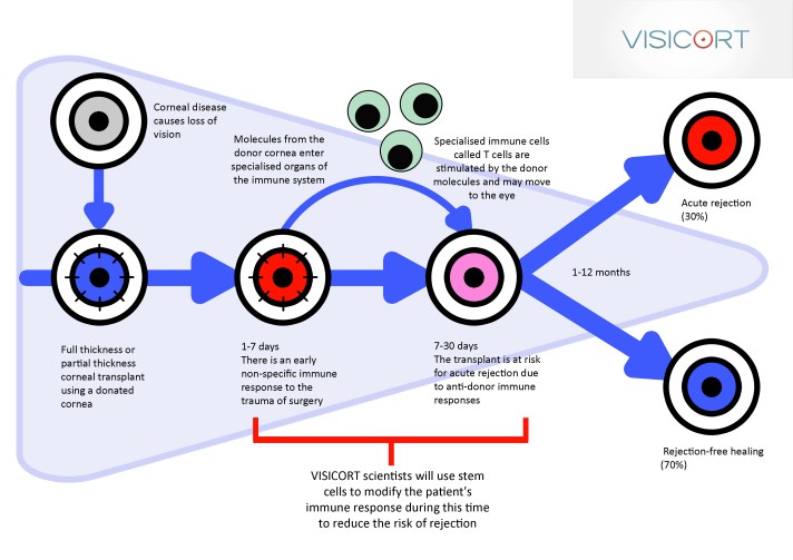 Diagram of current corneal transplantation leading to healing or rejection (Image courtesy of VISICORT)