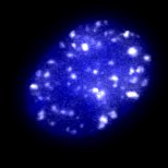 This cell has been treated with ionising radiation to induce DNA damage. Spots where the damage is being repaired can be seen in white and the nucleus is stained blue. (Image credig: Danielle Hamilton)